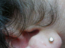 Female Sideburns Before