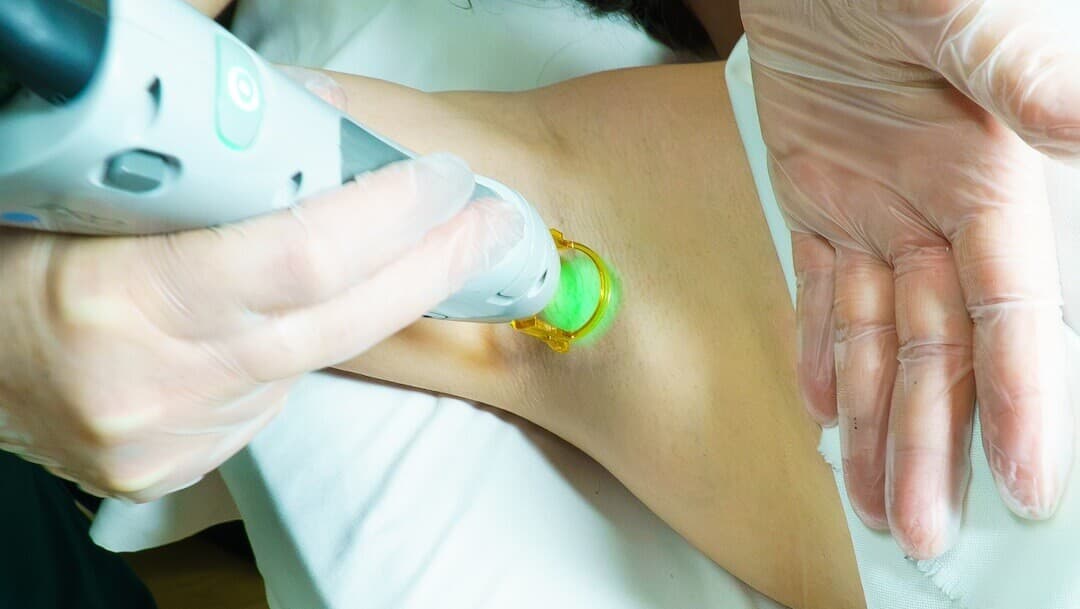 Medical professional in gloves applying a handheld device to a patient’s forearm, emitting green light in the treatment area.