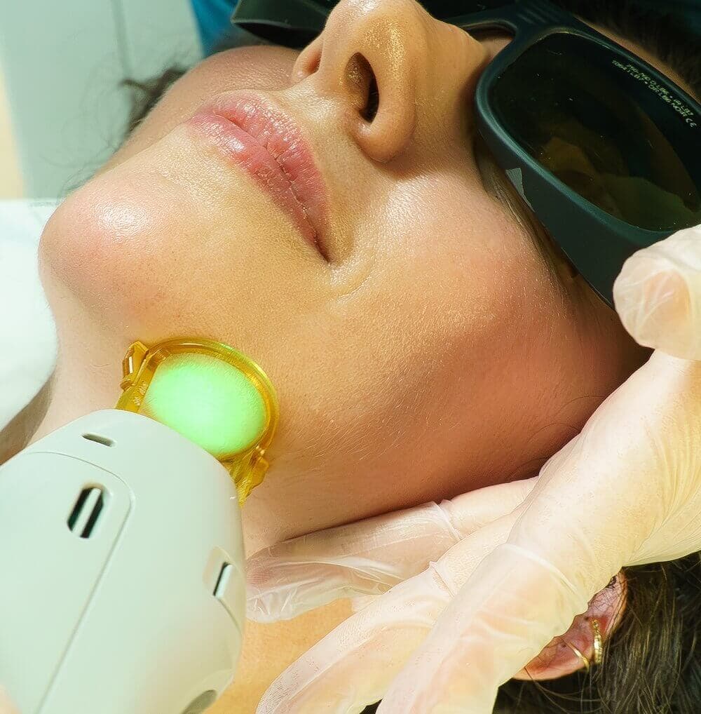 Close-up of a woman receiving a facial laser treatment on her jawline, wearing protective goggles while a clinician in gloves holds the device against her skin.